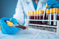 A researcher wearing gloves and a white coat holds up tubes of blood for testing
