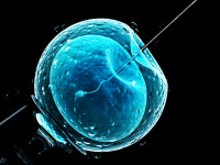 Podcast: Assisted reproductive technology: an overview of Cochrane Reviews