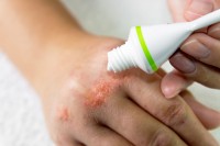 The findings of this research may challenge the prescribing of H1 antihistamines for patients with eczema.
