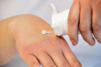 Featured Review: Treatments for hand eczema