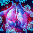 Lung Virus Infection stock photo